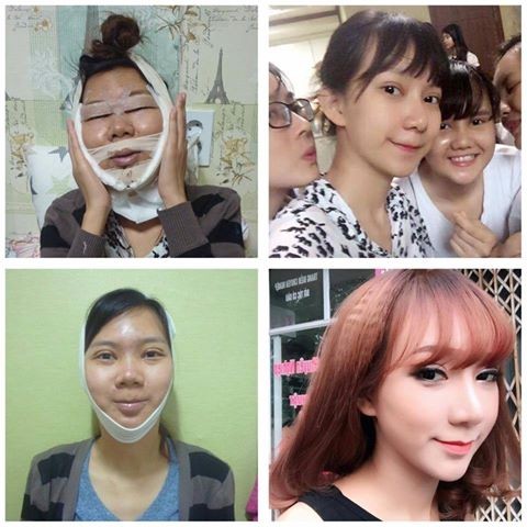 Bi che dan ong, “hot girl tra da” chi 65 trieu nang nguc-Hinh-5